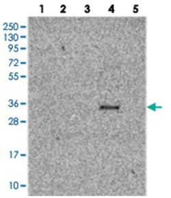 TMUB2, Rabbit, Polyclonal Antibody, Abnova 100 &mu;L | Buy Online | Abnova Corporation | Fisher Scientific