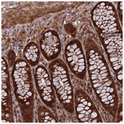TMUB2, Rabbit, Polyclonal Antibody, Abnova 100 &mu;L | Buy Online | Abnova Corporation | Fisher Scientific