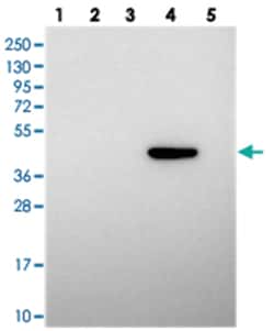 PRDM12, Rabbit, Polyclonal Antibody, Abnova 100&mu;L; Unlabeled:Antibodies,