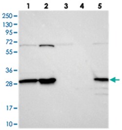 INO80E, Rabbit, Polyclonal Antibody, Abnova 100&mu;L; Unlabeled:Antibodies,
