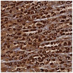 TMEM196, Rabbit, Polyclonal Antibody, Abnova 100&mu;L; Unlabeled:Antibodies,