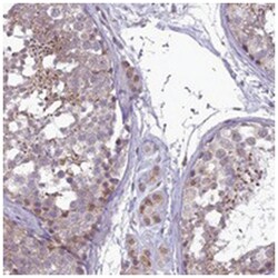 C14orf1, Rabbit, Polyclonal Antibody, Abnova 100 &mu;L | Buy Online | Abnova Corporation | Fisher Scientific
