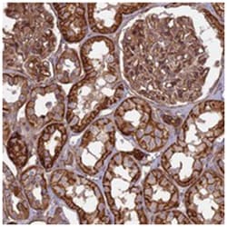 C20orf152, Rabbit, Polyclonal Antibody, Abnova 100&mu;L; Unlabeled:Antibodies,