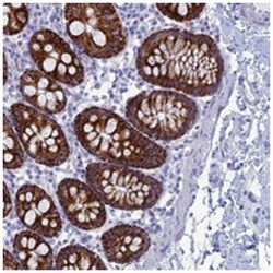 ALMS1, Rabbit, Polyclonal Antibody, Abnova 100 &mu;L | Buy Online | Abnova Corporation | Fisher Scientific
