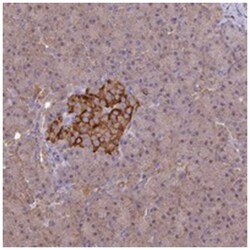 ARHGAP19, Rabbit, Polyclonal Antibody, Abnova 100&mu;L; Unlabeled:Antibodies,