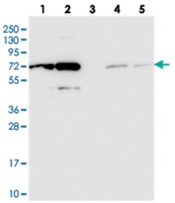 IRGQ, Rabbit, Polyclonal Antibody, Abnova 100 &mu;L | Buy Online | Abnova Corporation | Fisher Scientific