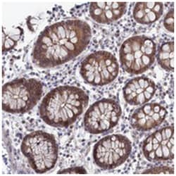 IRGQ, Rabbit, Polyclonal Antibody, Abnova 100 &mu;L | Buy Online | Abnova Corporation | Fisher Scientific