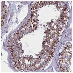 FAM129C, Rabbit, Polyclonal Antibody, Abnova 100 &mu;L | Buy Online | Abnova Corporation | Fisher Scientific