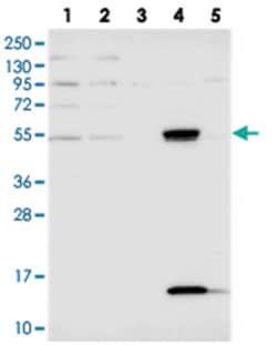UFSP2 Rabbit anti-Human, Polyclonal Antibody, Abnova 100 &mu;L | Buy Online | Abnova Corporation | Fisher Scientific