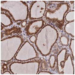 UFSP2 Rabbit anti-Human, Polyclonal Antibody, Abnova 100 &mu;L | Buy Online | Abnova Corporation | Fisher Scientific