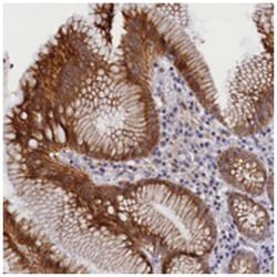 ANKRD34B, Rabbit, Polyclonal Antibody, Abnova 100&mu;L; Unlabeled:Antibodies,