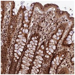 C3orf62, Rabbit, Polyclonal Antibody, Abnova 100 &mu;L | Buy Online | Abnova Corporation | Fisher Scientific