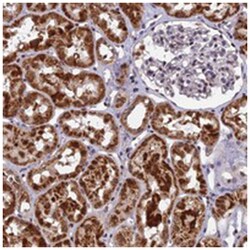 CMC1, Rabbit, Polyclonal Antibody, Abnova 100 &mu;L | Buy Online | Abnova | Fisher Scientific