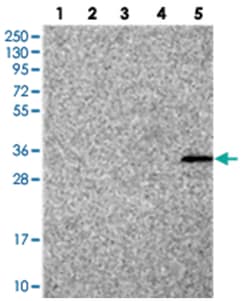 FAM70B, Rabbit, Polyclonal Antibody, Abnova 100 &mu;L | Buy Online | Abnova Corporation | Fisher Scientific