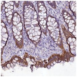 HIGD1A Rabbit anti-Human, Polyclonal Antibody, Abnova 100 &mu;L | Buy Online | Abnova | Fisher Scientific