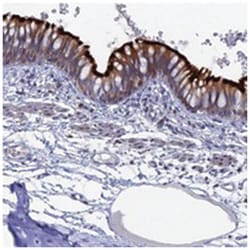 TMEM161A, Rabbit, Polyclonal Antibody, Abnova 100 &mu;L | Buy Online | Abnova Corporation | Fisher Scientific