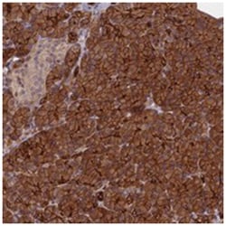 C4orf22, Rabbit, Polyclonal Antibody, Abnova 100&mu;L; Unlabeled:Antibodies,