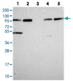 FAM160B1, Rabbit, Polyclonal Antibody, Abnova 100 &mu;L | Buy Online | Abnova Corporation | Fisher Scientific