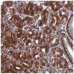 FAM160B1, Rabbit, Polyclonal Antibody, Abnova 100 &mu;L | Buy Online | Abnova Corporation | Fisher Scientific