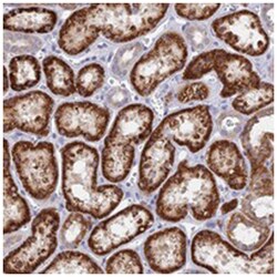 DNAJC16, Rabbit, Polyclonal Antibody, Abnova 100 &mu;L | Buy Online | Abnova Corporation | Fisher Scientific