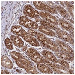 Abnova Corporation&nbsp;CCDC69, Rabbit, Polyclonal Antibody, Abnova&trade;