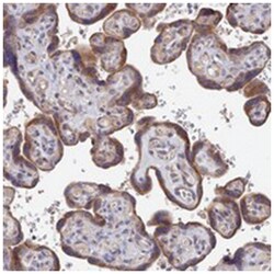 ZNF320, Rabbit, Polyclonal Antibody, Abnova 100&mu;L; Unlabeled:Antibodies,