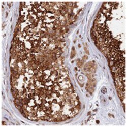 CABP5, Rabbit, Polyclonal Antibody, Abnova 100&mu;L; Unlabeled:Antibodies,