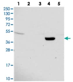 TMEM44, Rabbit, Polyclonal Antibody, Abnova 100&mu;L; Unlabeled:Antibodies,