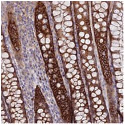 TMEM44, Rabbit, Polyclonal Antibody, Abnova 100&mu;L; Unlabeled:Antibodies,