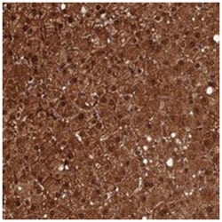 CRTC3, Rabbit, Polyclonal Antibody, Abnova 100 &mu;L | Buy Online | Abnova Corporation | Fisher Scientific