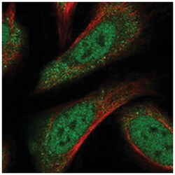CRTC3, Rabbit, Polyclonal Antibody, Abnova 100 &mu;L | Buy Online | Abnova Corporation | Fisher Scientific