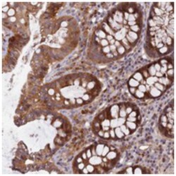 FAM151B, Rabbit, Polyclonal Antibody, Abnova 100&mu;L; Unlabeled:Antibodies,