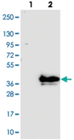 FAM151B, Rabbit, Polyclonal Antibody, Abnova 100&mu;L; Unlabeled:Antibodies,