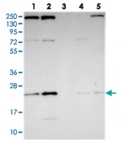 THOC7, Rabbit, Polyclonal Antibody, Abnova 100&mu;L; Unlabeled:Antibodies,