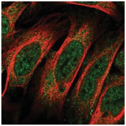 THOC7, Rabbit, Polyclonal Antibody, Abnova 100&mu;L; Unlabeled:Antibodies,