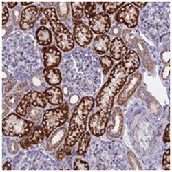 SAMD7, Rabbit, Polyclonal Antibody, Abnova 100 &mu;L | Buy Online | Abnova Corporation | Fisher Scientific