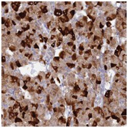 C17orf64, Rabbit, Polyclonal Antibody, Abnova 100 &mu;L | Buy Online | Abnova Corporation | Fisher Scientific