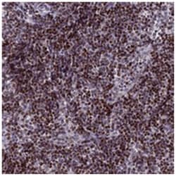 AFF3, Rabbit, Polyclonal Antibody, Abnova 100 &mu;L | Buy Online | Abnova Corporation | Fisher Scientific
