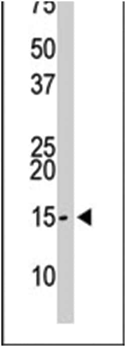 SUMO2/3 Rabbit anti-Human, Polyclonal Antibody, Abnova 400 &mu;L | Buy Online | Abnova Corporation | Fisher Scientific