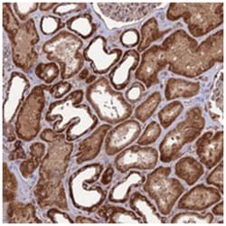 NDUFC1, Rabbit, Polyclonal Antibody, Abnova 100&mu;L; Unlabeled:Antibodies,