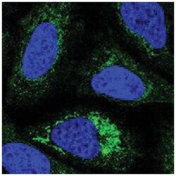 NDUFC1, Rabbit, Polyclonal Antibody, Abnova 100&mu;L; Unlabeled:Antibodies,
