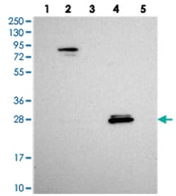 SPIN4, Rabbit, Polyclonal Antibody, Abnova 100 &mu;L | Buy Online | Abnova Corporation | Fisher Scientific