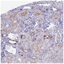 TMEM161B, Rabbit, Polyclonal Antibody, Abnova 100&mu;L; Unlabeled:Antibodies,