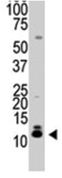 SUMO2/3 Rabbit anti-Human, Mouse, Polyclonal Antibody, Abnova 400 &mu;L | Buy Online | Abnova Corporation | Fisher Scientific