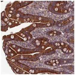 C15orf62, Rabbit, Polyclonal Antibody, Abnova 100&mu;L; Unlabeled:Antibodies,