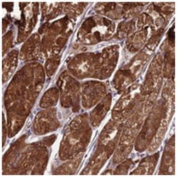 TBC1D24, Rabbit, Polyclonal Antibody, Abnova 100 &mu;L | Buy Online | Abnova Corporation | Fisher Scientific