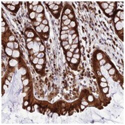 JSRP1, Rabbit, Polyclonal Antibody, Abnova 100 &mu;L | Buy Online | Abnova Corporation | Fisher Scientific