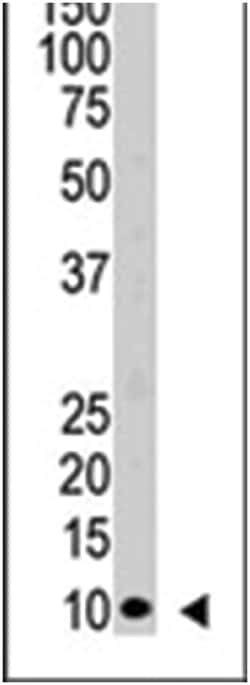 UBB Rabbit anti-Human, Polyclonal Antibody, Abnova 400 &mu;L | Buy Online | Abnova Corporation | Fisher Scientific
