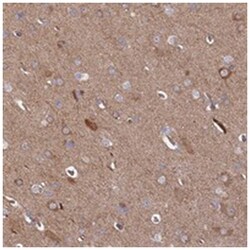 INSM2 Rabbit anti-Human, Polyclonal Antibody, Abnova 100&mu;L; Unlabeled:Antibodies,