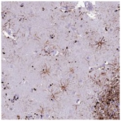 IFT172, Rabbit, Polyclonal Antibody, Abnova 100 &mu;L | Buy Online | Abnova Corporation | Fisher Scientific